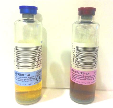 dat blood test bottle|purple top bottle blood culture.